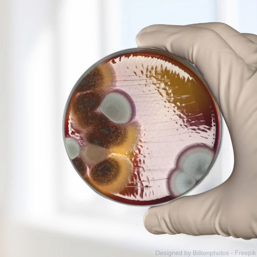 Eine Hand in Gummihandschuh hält eine Petrischale in der sich Schimmel gebildet hat